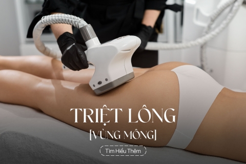 Triệt lông vùng Mông